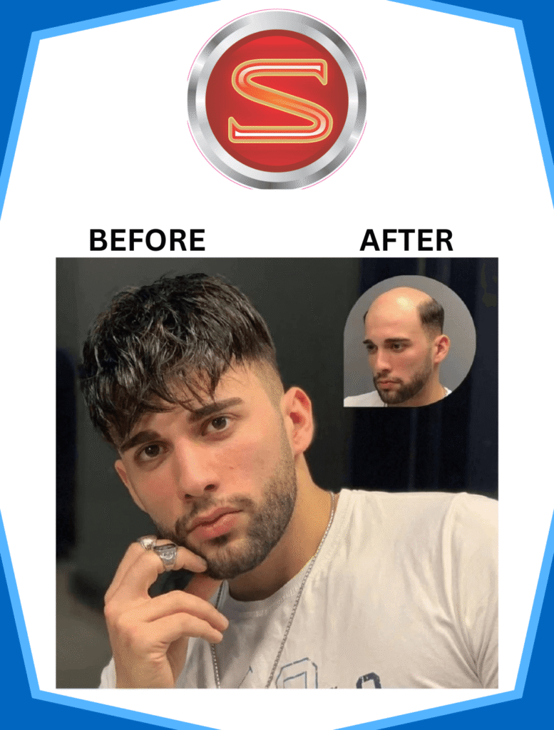 hair patch services in lucknow